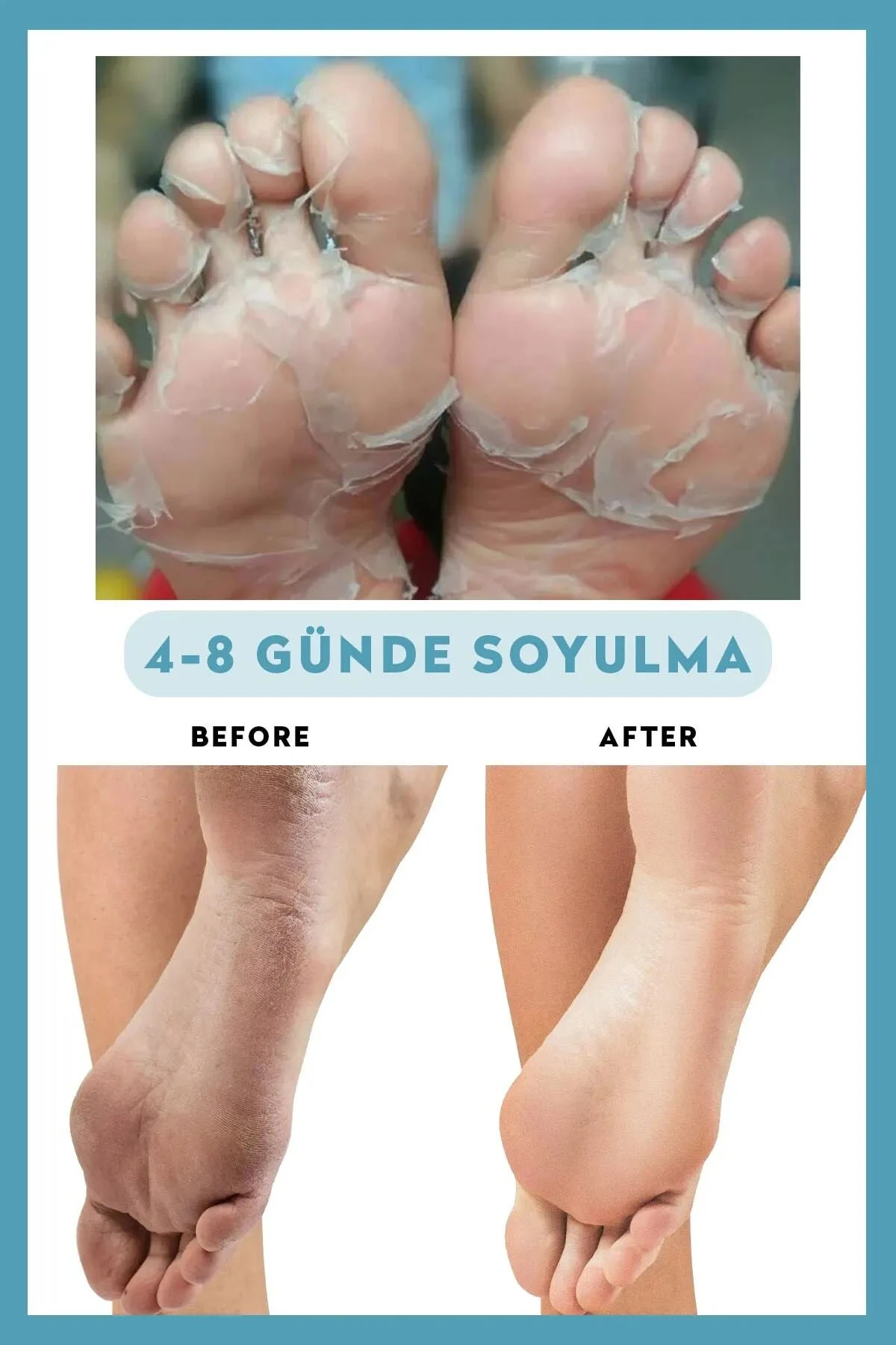Dermokil Peeling Etkili Soyulabilen Ayak Maskesi 30 ml 252564