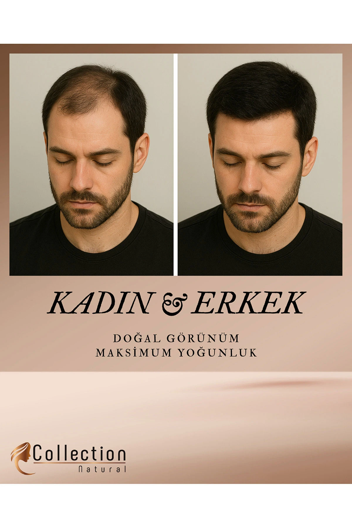 Siyah Collection Naturel Hair Color Topik (Saç Dolgunlaştırıcı saç fiberi) Black 27 Gr 473218