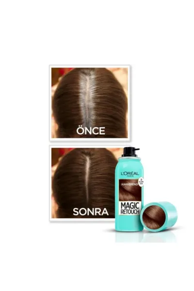 Loreal Paris Magic Retouch Beyazlar İçin Anında Kapatıcı Sprey Kahverengi 75 ml 275599