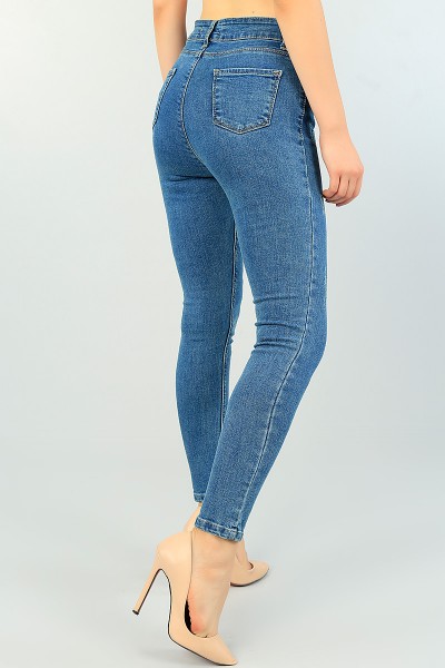Mavi Lazer Kesim Likralı Bayan Kot Pantolon 73087