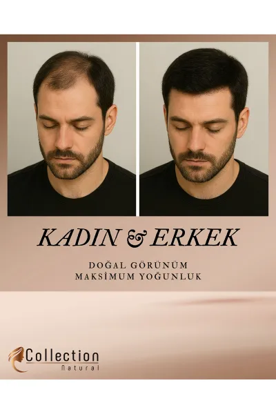 Siyah Collection Naturel Hair Color Topik (Saç Dolgunlaştırıcı saç fiberi) Black 27 Gr 473218
